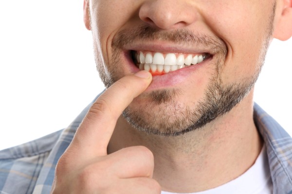 Periodontal Treatments From Your Dentist